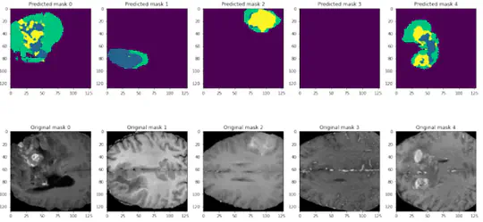 3D Brain tumor segmentation